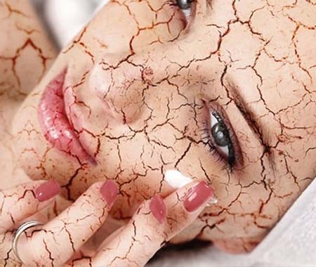 Een verstoorde huidbarrière. En dan?